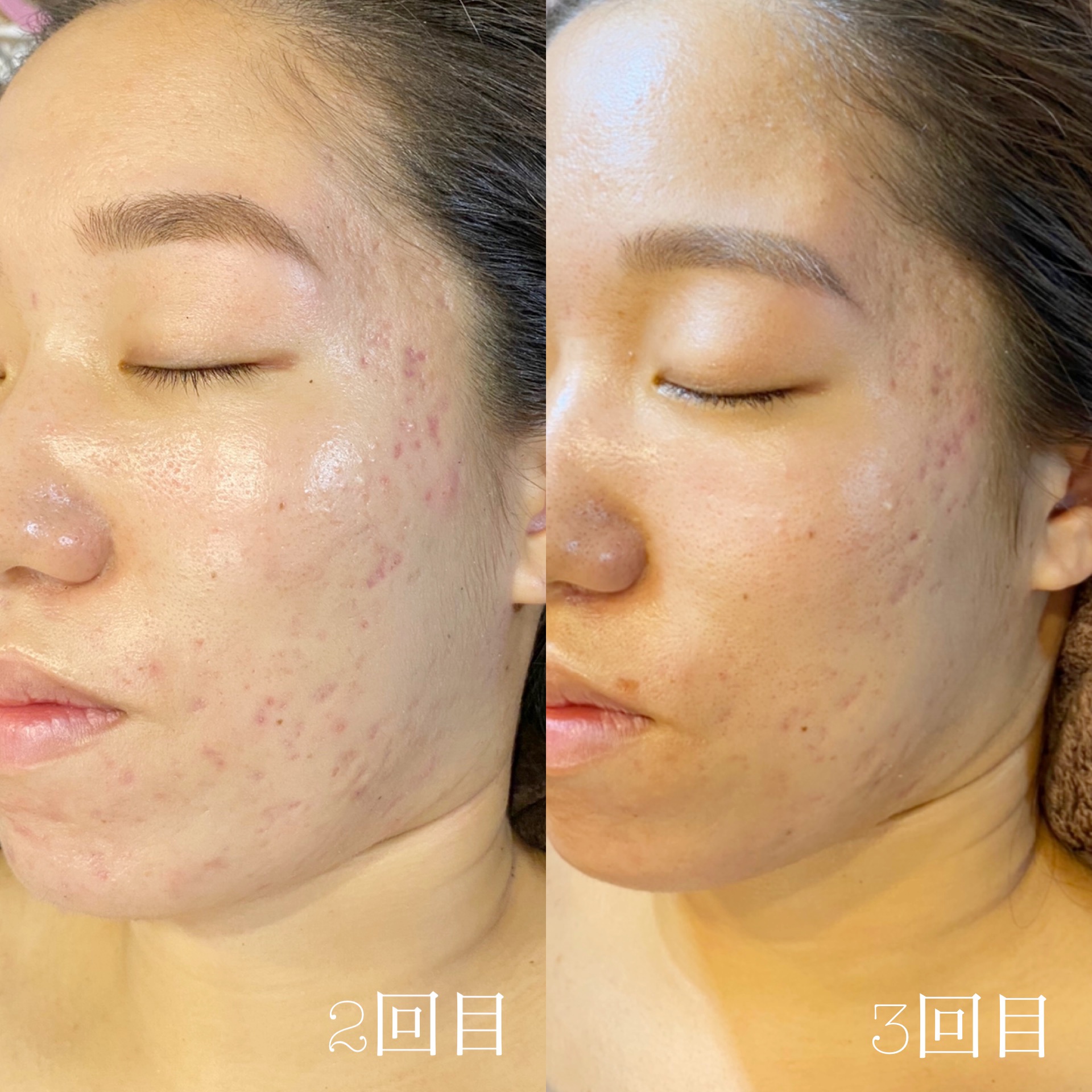 陶肌トリートメントおすすめオプションメニュー～ - Lea Lourdes